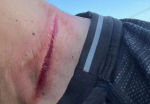 Enduro, motociclista disarcionato da un cavo d’acciaio nel bosco: si indaga per tentato omicidio